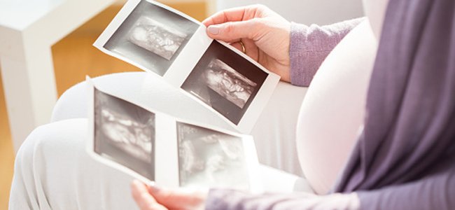 a-síndrome-do-gêmeo-evanescente A a-síndrome-do-gêmeo-evanescente A