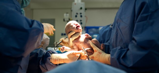 etapas-do-parto-expulsão-da-placenta A