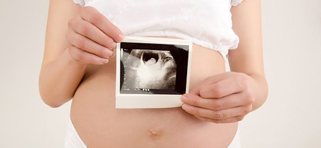 hipotireoidismo-na-gravidez A hipotireoidismo-na-gravidez A