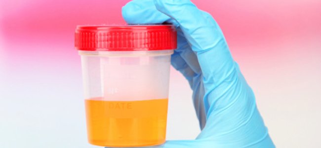 infecção-urinária-na-gravidez A