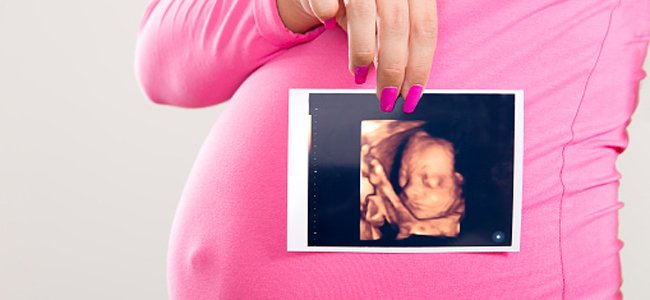 o-hipotireoidismo-no-feto A o-hipotireoidismo-no-feto A