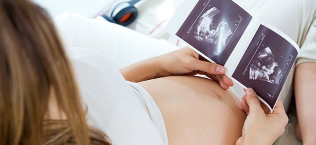 o-zika-vírus-está-relacionado-microcefalia A